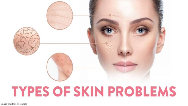 WHAT ARE COMMON CAUSES OF SKIN PROBLEMS? HOW TO AVOID SKIN PROBLEMS?