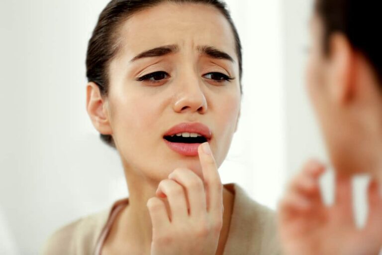 HOW TO TREAT A COLD SORE?